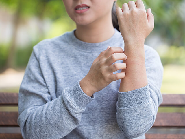 Tips to Manage and Prevent Itchy Skin Allergies | BENADRYL® Canada